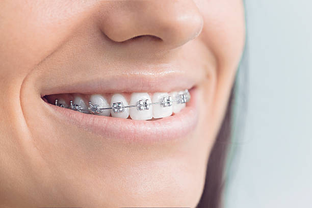 Best Traditional Braces  in Augusta, KY